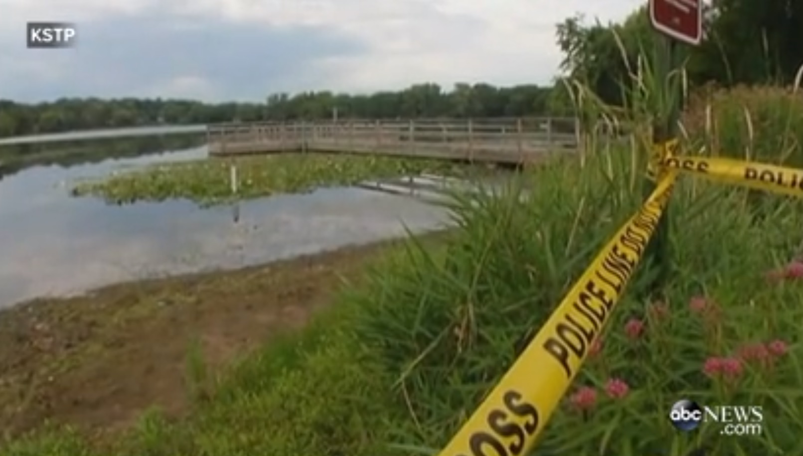 Teen dies from rare braineating amoeba after swimming in a lake
