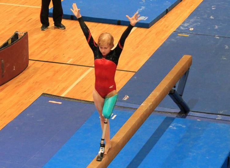 One-legged gymnast defies the odds | whas11.com